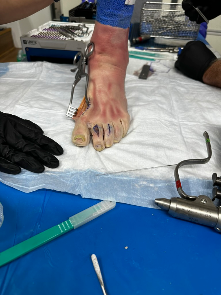 B844BC75-8DFB-4249-94BD-889F6B8743A7_1_105_c